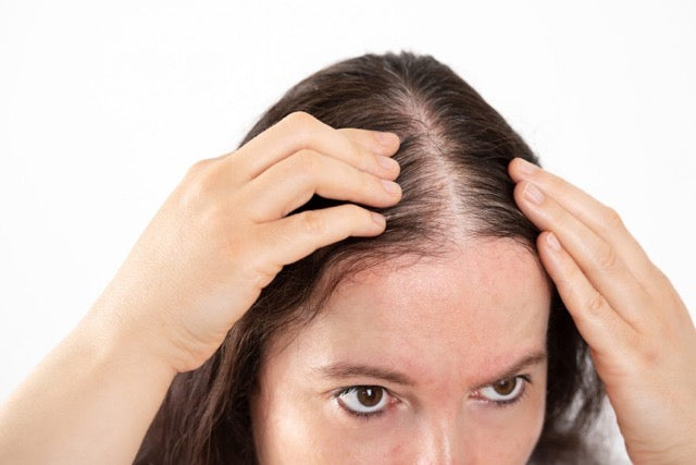 Decoding Hair Loss in Women: A Comprehensive Guide