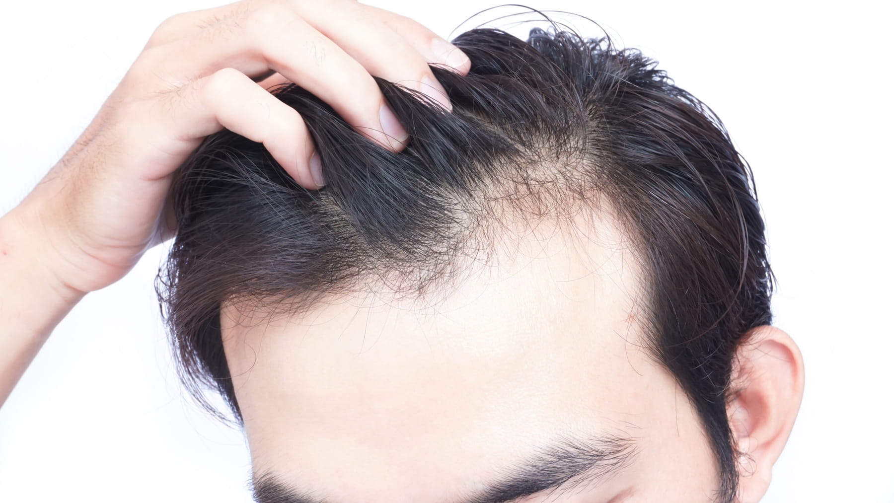 Natural Hair Growth Solutions That Work Better Than Minoxidil And Finasteride?